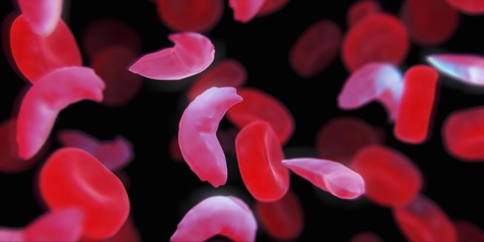 Red Blood Cell Pathology and Vulnerability